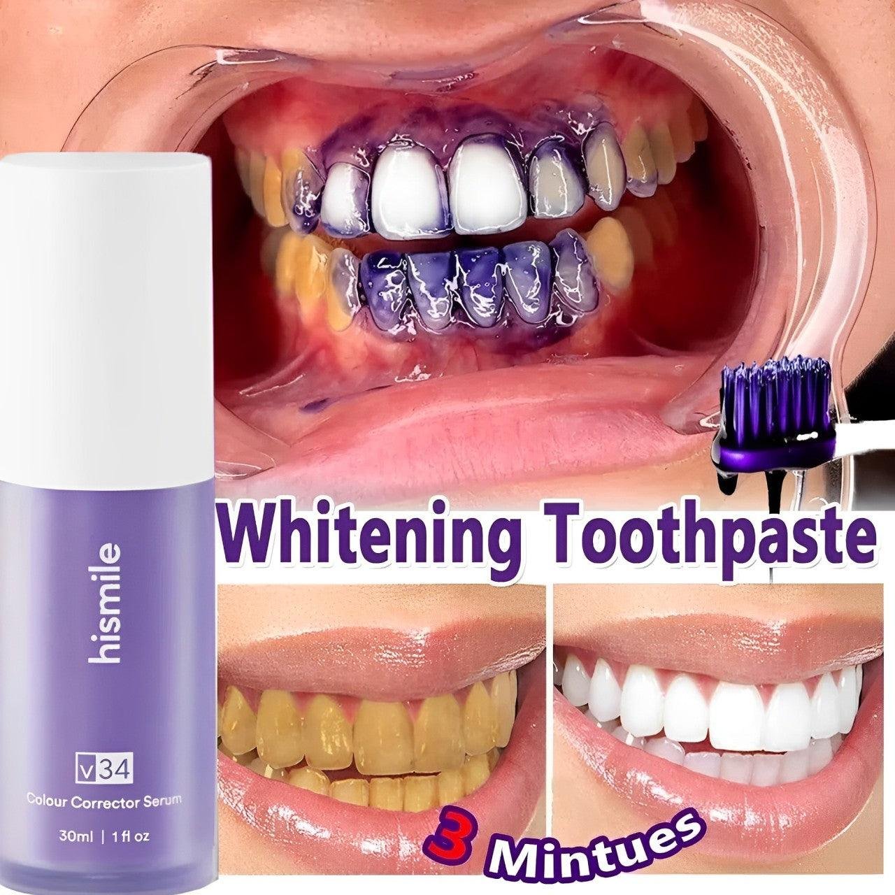 HiSmile Teeth Whitening Serum - Image 5