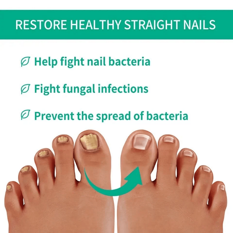 Nail Fungus Treatment Serum - Image 4